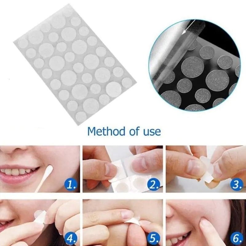 New Antiques Face Acne Pimple Spot Scar Care Treatment Stickers